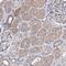 TRPM8 Channel Associated Factor 2 antibody, NBP1-91881, Novus Biologicals, Immunohistochemistry frozen image 