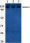 Histone Deacetylase 9 antibody, PA5-75908, Invitrogen Antibodies, Western Blot image 