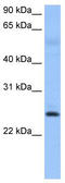 Rhophilin Associated Tail Protein 1B antibody, TA339957, Origene, Western Blot image 