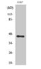 CCAAT/enhancer-binding protein alpha antibody, STJ91917, St John