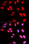 Pre-MRNA Processing Factor 3 antibody, 19-691, ProSci, Immunofluorescence image 