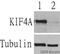 Kinesin Family Member 4A antibody, ab3815, Abcam, Western Blot image 