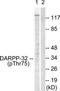 Protein Phosphatase 1 Regulatory Inhibitor Subunit 1B antibody, TA312426, Origene, Western Blot image 