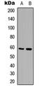 Serine/Threonine Kinase 4 antibody, GTX54995, GeneTex, Western Blot image 