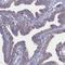 Coiled-Coil Domain Containing 13 antibody, HPA047429, Atlas Antibodies, Immunohistochemistry frozen image 
