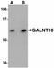 Polypeptide N-Acetylgalactosaminyltransferase 10 antibody, LS-B5016, Lifespan Biosciences, Western Blot image 