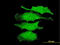 Mitogen-Activated Protein Kinase 4 antibody, LS-C197994, Lifespan Biosciences, Immunofluorescence image 