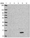 Alpha-defensin 1 antibody, NBP2-46808, Novus Biologicals, Western Blot image 