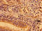 Mitogen-Activated Protein Kinase Kinase Kinase 9 antibody, LS-C674993, Lifespan Biosciences, Immunohistochemistry paraffin image 