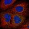 Armadillo Like Helical Domain Containing 3 antibody, NBP2-30723, Novus Biologicals, Immunofluorescence image 