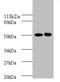 Ornithine Decarboxylase 1 antibody, A52669-100, Epigentek, Western Blot image 
