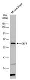 Rho guanine nucleotide exchange factor 25 antibody, NBP2-16636, Novus Biologicals, Western Blot image 