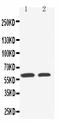 Solute Carrier Family 22 Member 1 antibody, PA2172, Boster Biological Technology, Western Blot image 
