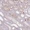 Mitochondrial Calcium Uniporter Dominant Negative Beta Subunit antibody, HPA048776, Atlas Antibodies, Immunohistochemistry paraffin image 