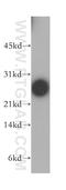 DIRAS Family GTPase 1 antibody, 12634-1-AP, Proteintech Group, Western Blot image 