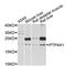 Protein tyrosine phosphatase type IVA 1 antibody, STJ114238, St John