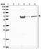 Pre-MRNA Processing Factor 38B antibody, NBP2-30709, Novus Biologicals, Western Blot image 
