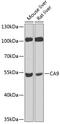Carbonic Anhydrase 9 antibody, 16-663, ProSci, Western Blot image 
