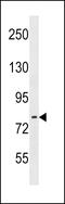 Rho Guanine Nucleotide Exchange Factor 33 antibody, 60-428, ProSci, Western Blot image 