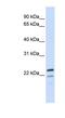 Receptor Accessory Protein 1 antibody, NBP1-62374, Novus Biologicals, Western Blot image 