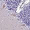 Divergent Protein Kinase Domain 1B antibody, PA5-61338, Invitrogen Antibodies, Immunohistochemistry frozen image 