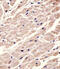 Muscarinic acetylcholine receptor M2 antibody, M02733, Boster Biological Technology, Immunohistochemistry paraffin image 