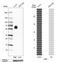 V-Set Immunoregulatory Receptor antibody, HPA007968, Atlas Antibodies, Western Blot image 