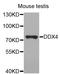 DEAD-Box Helicase 4 antibody, abx126882, Abbexa, Western Blot image 