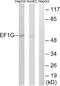 Eukaryotic Translation Elongation Factor 1 Gamma antibody, A30670, Boster Biological Technology, Western Blot image 