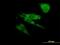 Sodium Voltage-Gated Channel Alpha Subunit 8 antibody, H00006334-M04, Novus Biologicals, Immunocytochemistry image 