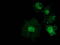 Catenin Beta 1 antibody, TA502338, Origene, Immunofluorescence image 