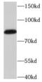 Nuclear Cap Binding Protein Subunit 1 antibody, FNab05581, FineTest, Western Blot image 