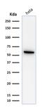 Heat Shock Protein Family D (Hsp60) Member 1 antibody, GTX34786, GeneTex, Western Blot image 
