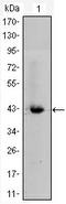 Catenin Beta 1 antibody, AM06389SU-N, Origene, Western Blot image 