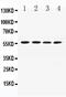 Angiotensinogen antibody, A02103-1, Boster Biological Technology, Western Blot image 
