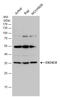 Exosome Component 8 antibody, GTX118146, GeneTex, Western Blot image 