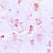 BCL2 antibody, LS-C351894, Lifespan Biosciences, Immunohistochemistry paraffin image 