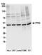 Peptidyl-prolyl cis-trans isomerase D antibody, A305-334A, Bethyl Labs, Western Blot image 