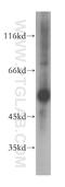 Glutamic--Pyruvic Transaminase antibody, 16897-1-AP, Proteintech Group, Western Blot image 