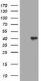 Sialidase-1 antibody, TA801668, Origene, Western Blot image 