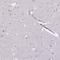 CD40 Molecule antibody, HPA031567, Atlas Antibodies, Immunohistochemistry frozen image 