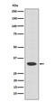 Orthodenticle Homeobox 2 antibody, M02006-1, Boster Biological Technology, Western Blot image 