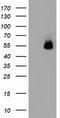 Sequestosome 1 antibody, CF502132, Origene, Western Blot image 