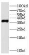 Parvin Gamma antibody, FNab06164, FineTest, Western Blot image 