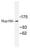Nuclear pore complex protein Nup160 antibody, AP01491PU-N, Origene, Western Blot image 