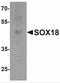 SRY-Box 18 antibody, NBP2-41289, Novus Biologicals, Western Blot image 