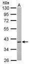 Calcium/Calmodulin Dependent Protein Kinase ID antibody, TA309027, Origene, Western Blot image 