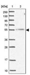 Microspherule Protein 1 antibody, PA5-58639, Invitrogen Antibodies, Western Blot image 