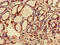 Chromosome 12 Open Reading Frame 43 antibody, LS-C397866, Lifespan Biosciences, Immunohistochemistry paraffin image 