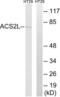 AceCS2 antibody, LS-C198588, Lifespan Biosciences, Western Blot image 